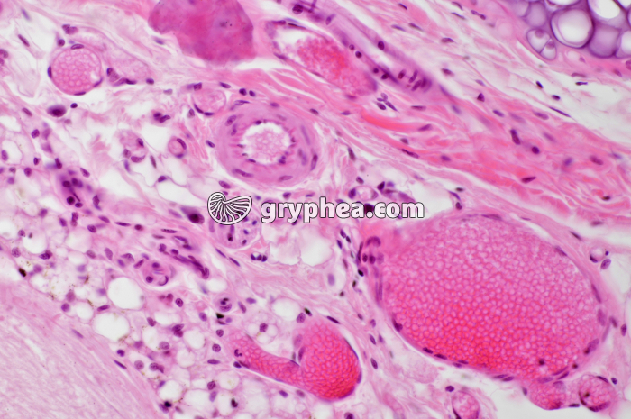 Trachée Rat x100 - gryphea.com